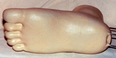 medical sculpture of foot-bottom view-by Lawrence Kinney